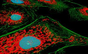 Fluorescence microscopy