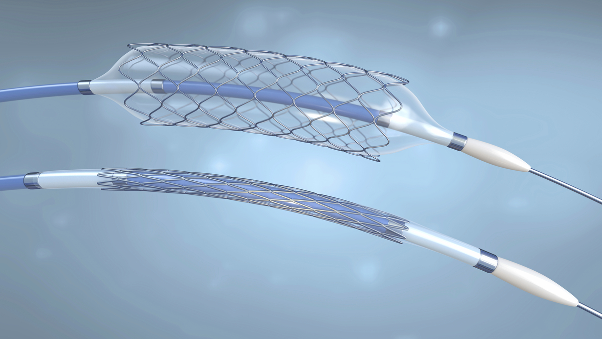 Deflated and inflated stents and balloon catheters, illustration.