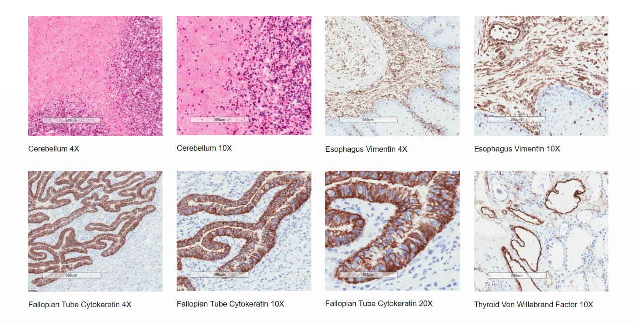 Frozen Human Tissue Quality Assessment Examples. First Row: Cerebellum 4x, Cerebellum 10x, Esophagus Vimentin 4x, Esophagus Vimentin 10x. Second Row: Fallopian Tube Cytokeratim 4x, Fallopian Tube Cytokeratim 10x, Fallopian Tube Cytokeratim 20x, Thyroid Von Willebrand Factor 10x