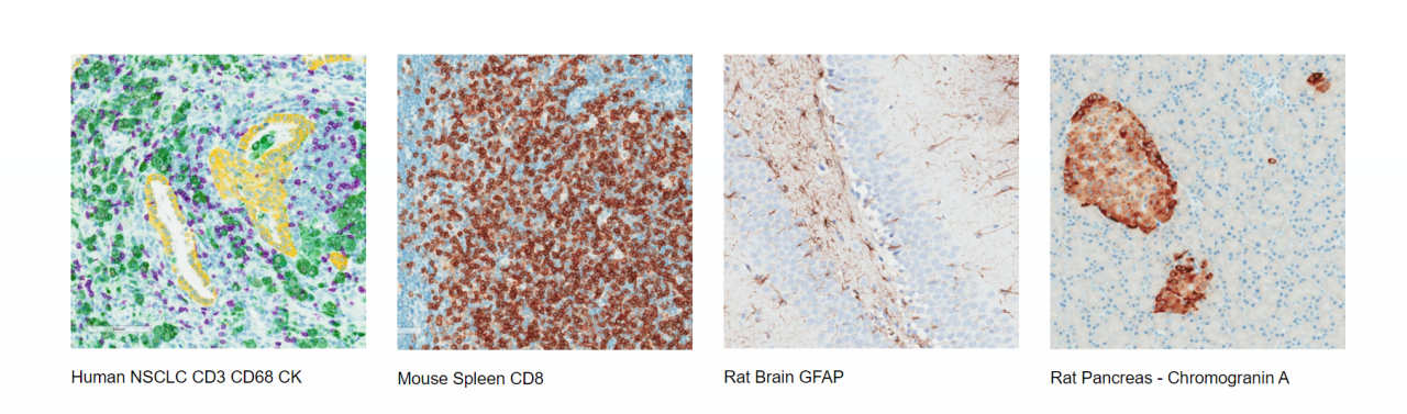 Four images from left to right. First: Human NSCLC CD3 CD68 CK. Second: Mouse Spleen CD8. Third: Rat Brain GFAP. Fourth: Rat Pancreas - Chromogranin A